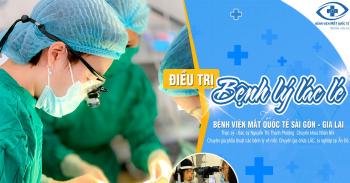 6 cách nhận biết trẻ bị bệnh lý lác lé