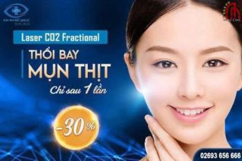 Laser xóa Mụn Đá – Mụn Thịt – Ban vàng sắc tố